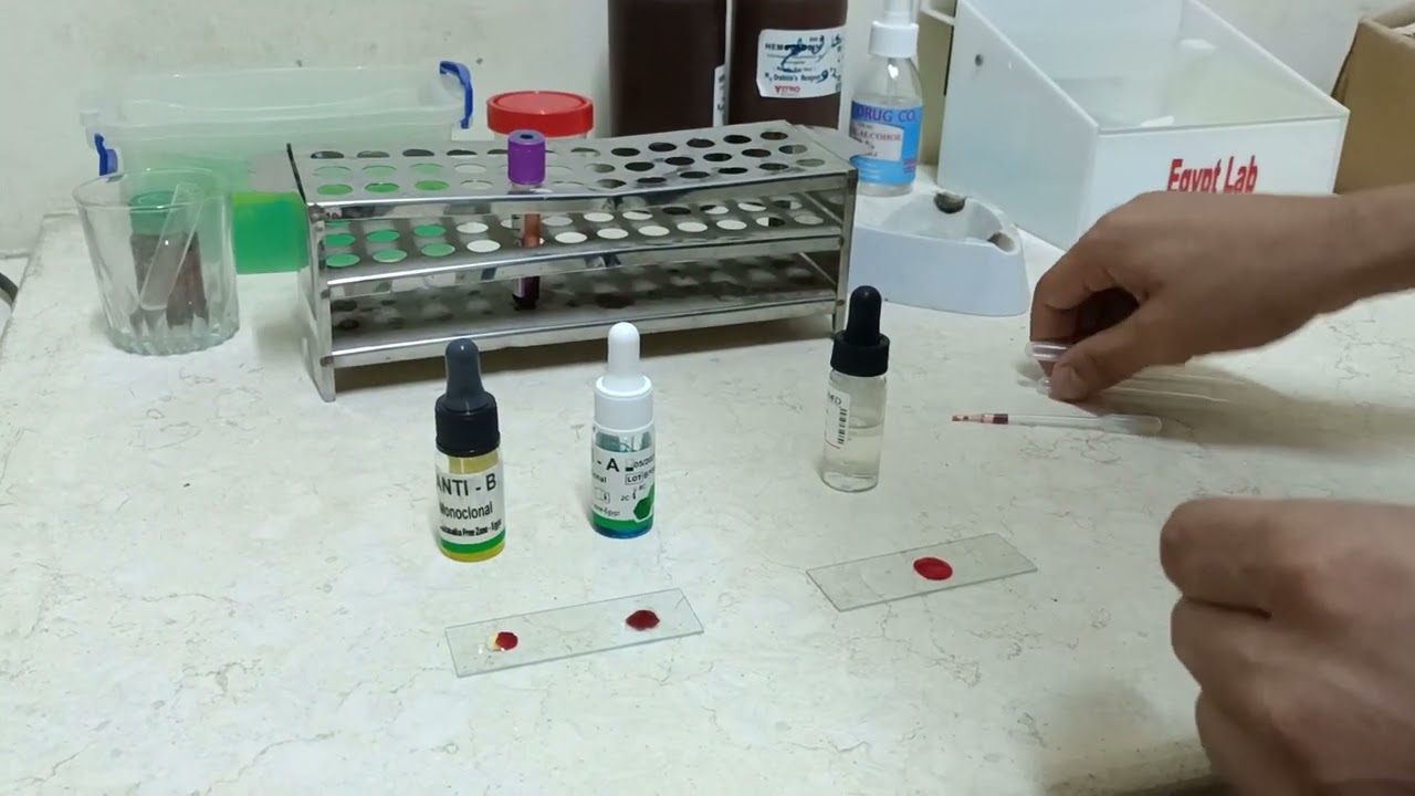 شرح تحليل فصيله الدم و ال Rh بالتفصيل.             Dr.Mohamed Abdelnabi
