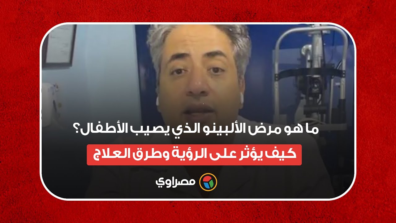 ما هو مرض الألبينو الذي يصيب الأطفال؟ كيف يؤثر على الرؤية وطرق العلاج