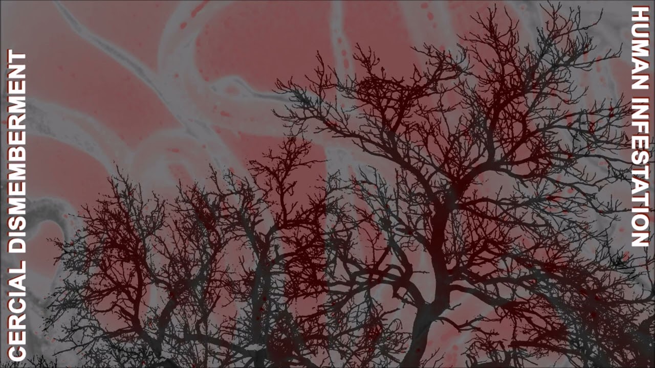 Cercial Dismemberment - Cauldron full of boiling vomit