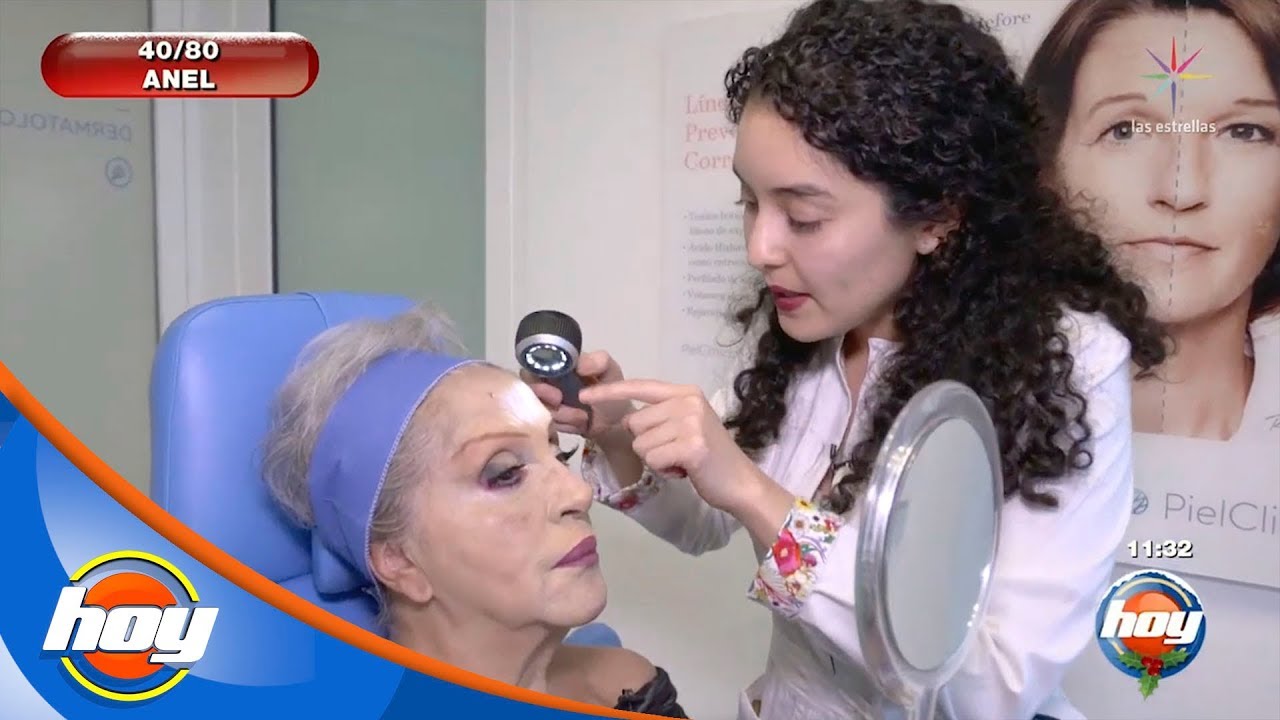 Anel Noreña demuestra que nunca es tarde para cuidar la piel | 40 y 80 | Hoy