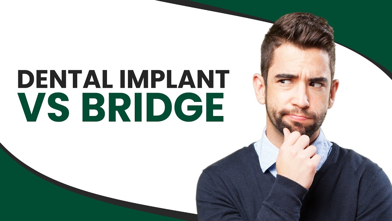 Dental Implant vs Bridge