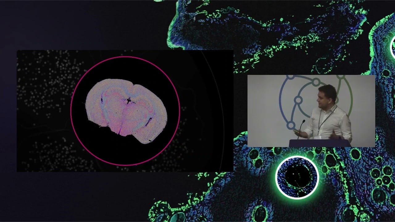 Exploring the Spatial Dimension with MERSCOPE
