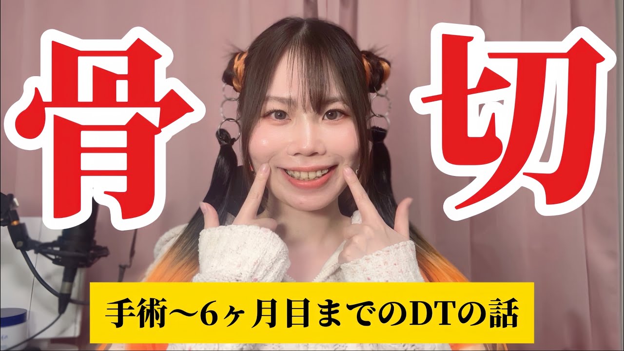ルフォー+SSROから6ヵ月！術後のダウンタイムの過ごし方＆半年間の経過報告【顎変形症】