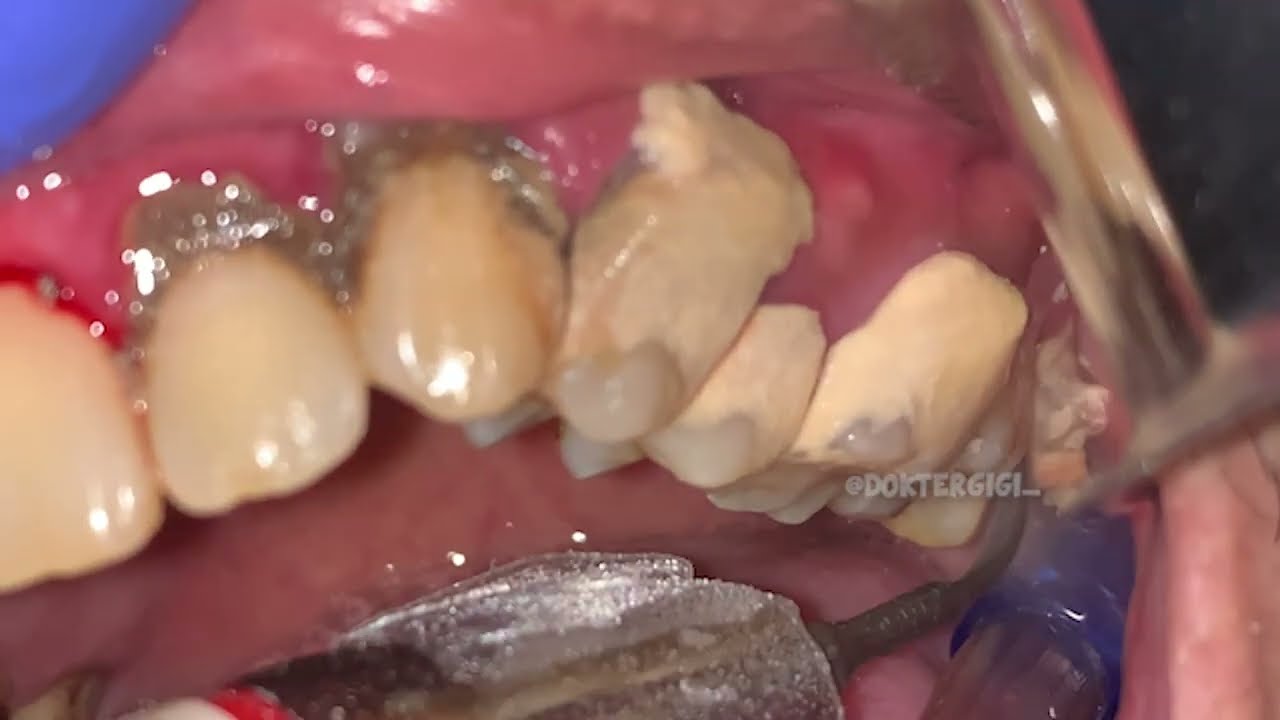 How can someone go about their day with teeth like this?