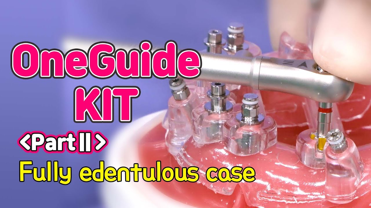 [EASY Hands-on] OneGuide KIT PartⅡ - Fully edentulous case