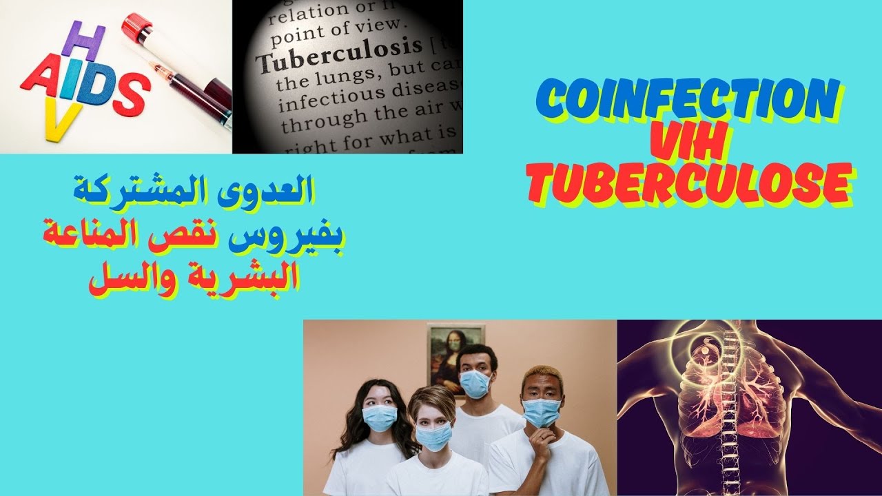 La Tuberculose tue plus les patients VIH que vous ne le pensez