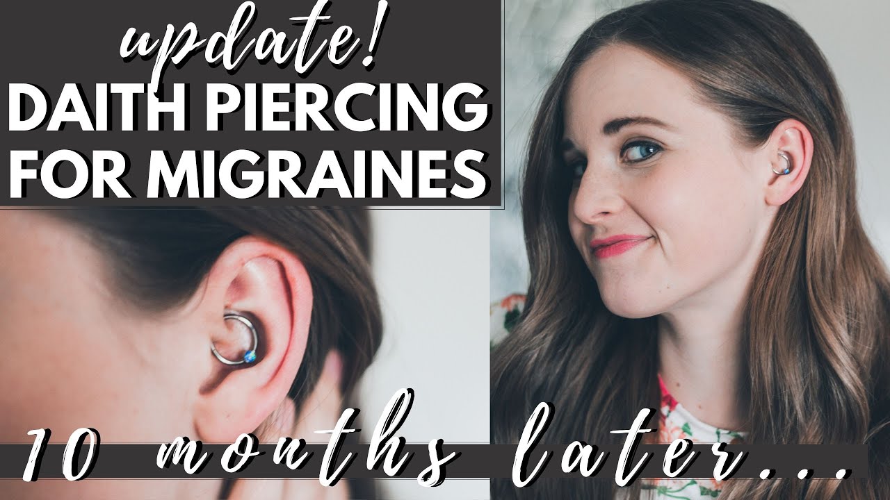 DID THE DAITH PIERCING HELP MY MIGRAINES?? | Migraine Update 10 Months with the Daith Ear Piercing