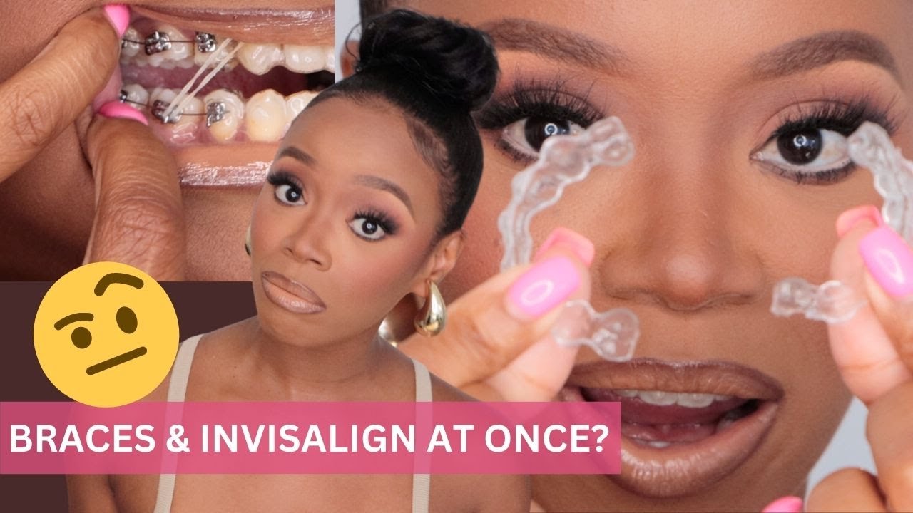 Я в бешенстве! Теперь у меня брекеты и Invisalign одновременно? Обновление Invisalign