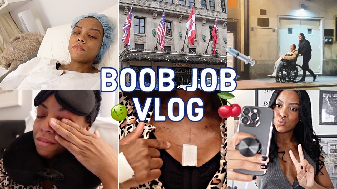 I GOT YITTIES!!! My boob job vlog + 7 day recovery experience - Feb 2024