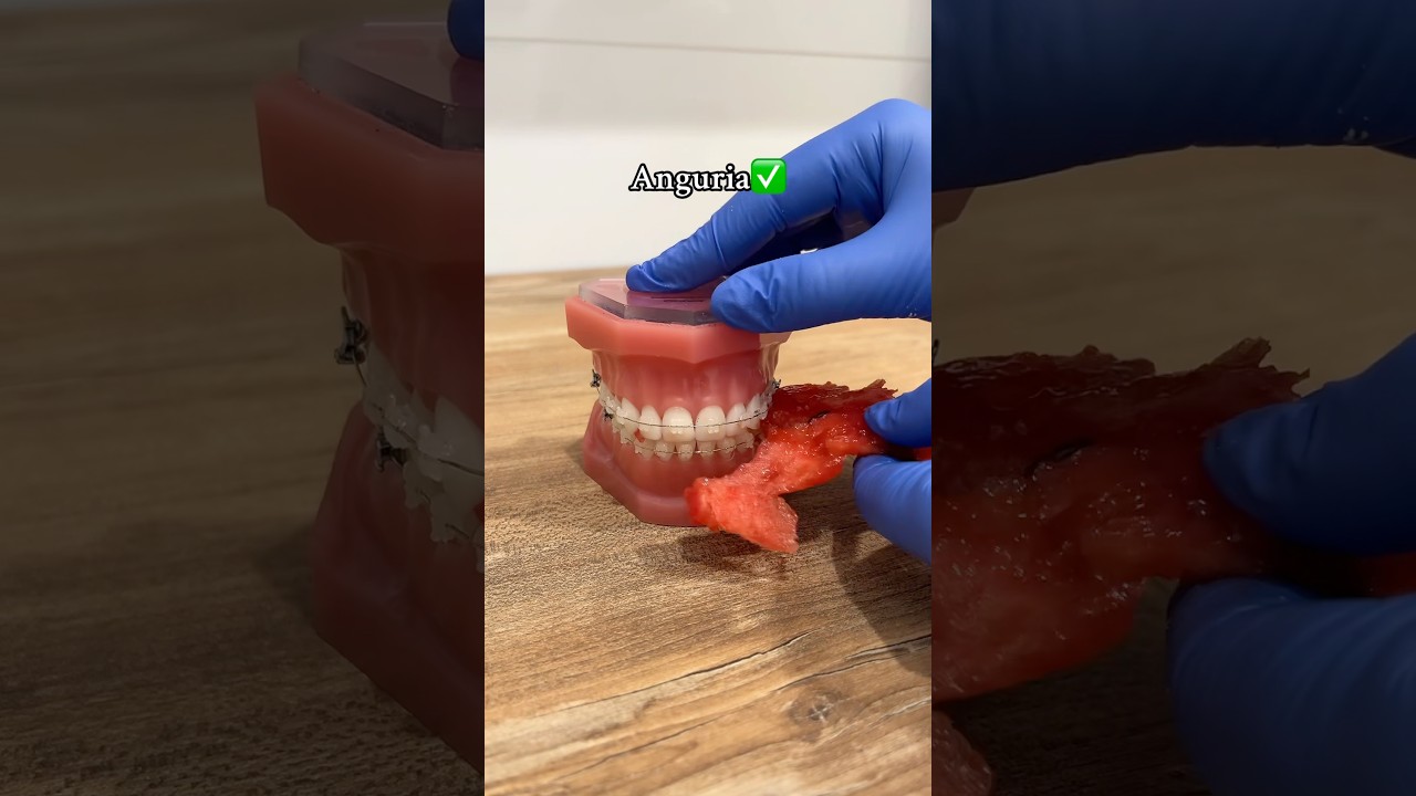 👍 o 👎? #oralcare  #ortodonciainvisible #cibo #alimenti #dentista #apparecchio #dentaltips