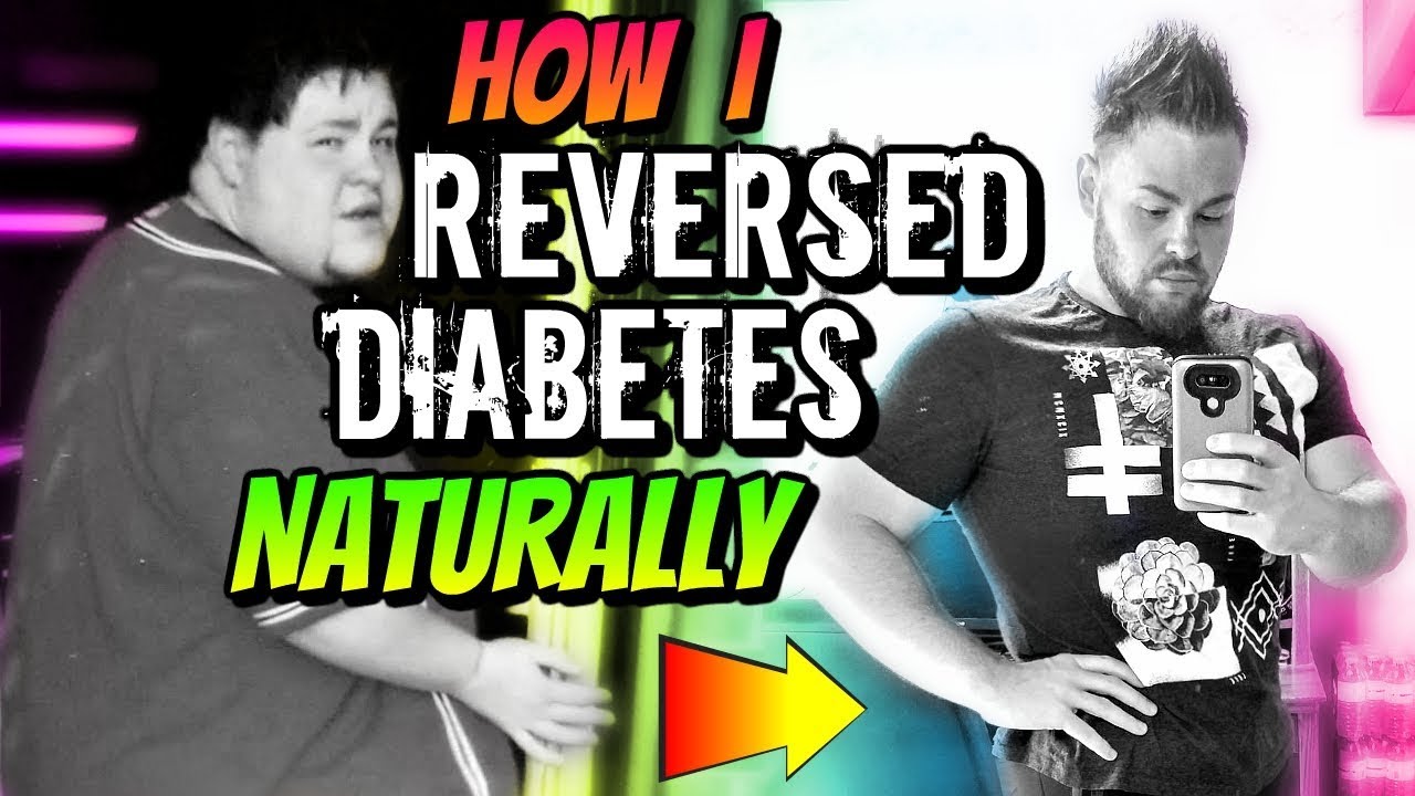 HOW I REVERSED TYPE 2 DIABETES NATURALLY & LOST 130 POUNDS