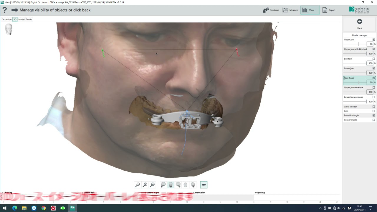 zebris WinJMA Digital Occulusion 3D Face Image Import Adjustment Setup