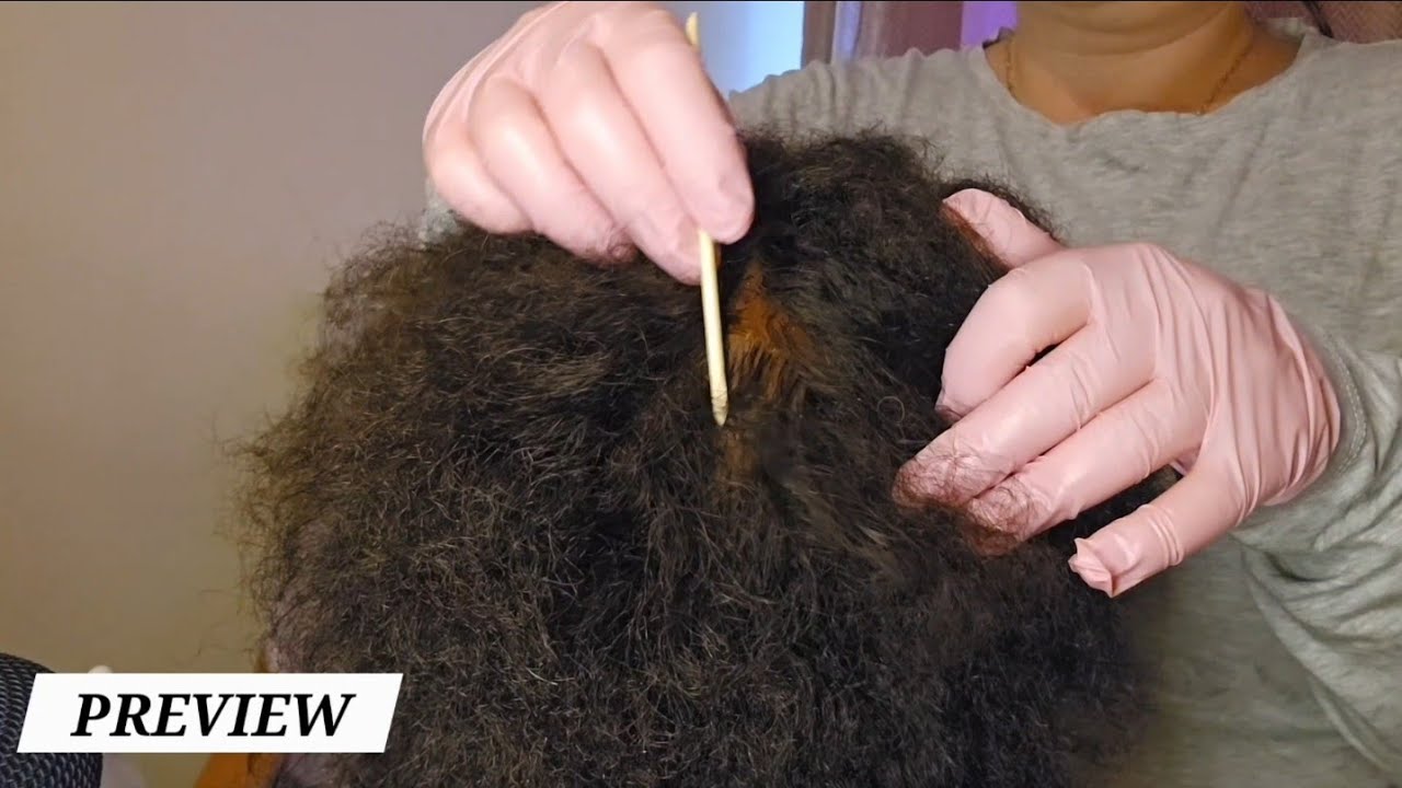 ASMR ✨️ SCALP CHECK & NITPICKING (no talking) with gloves