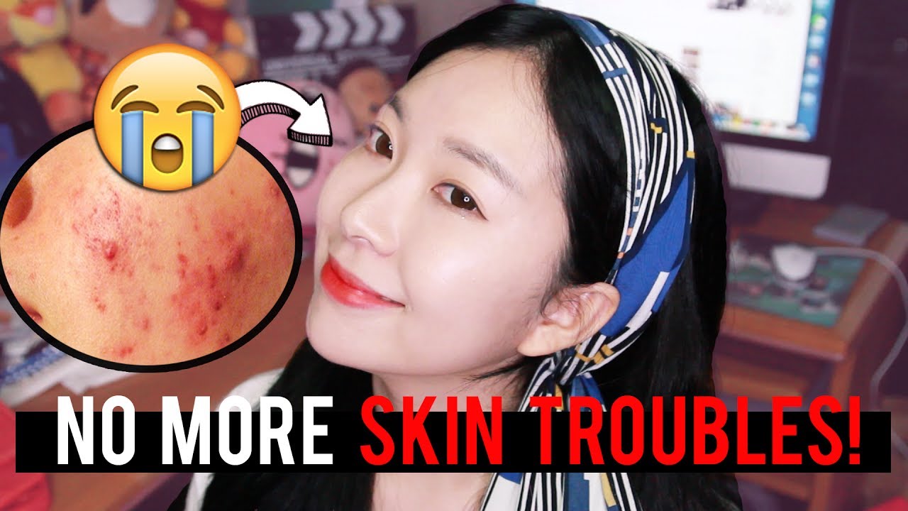 15 YEARS WITH ACNE.. My Skincare Routine for Sensitive Skin