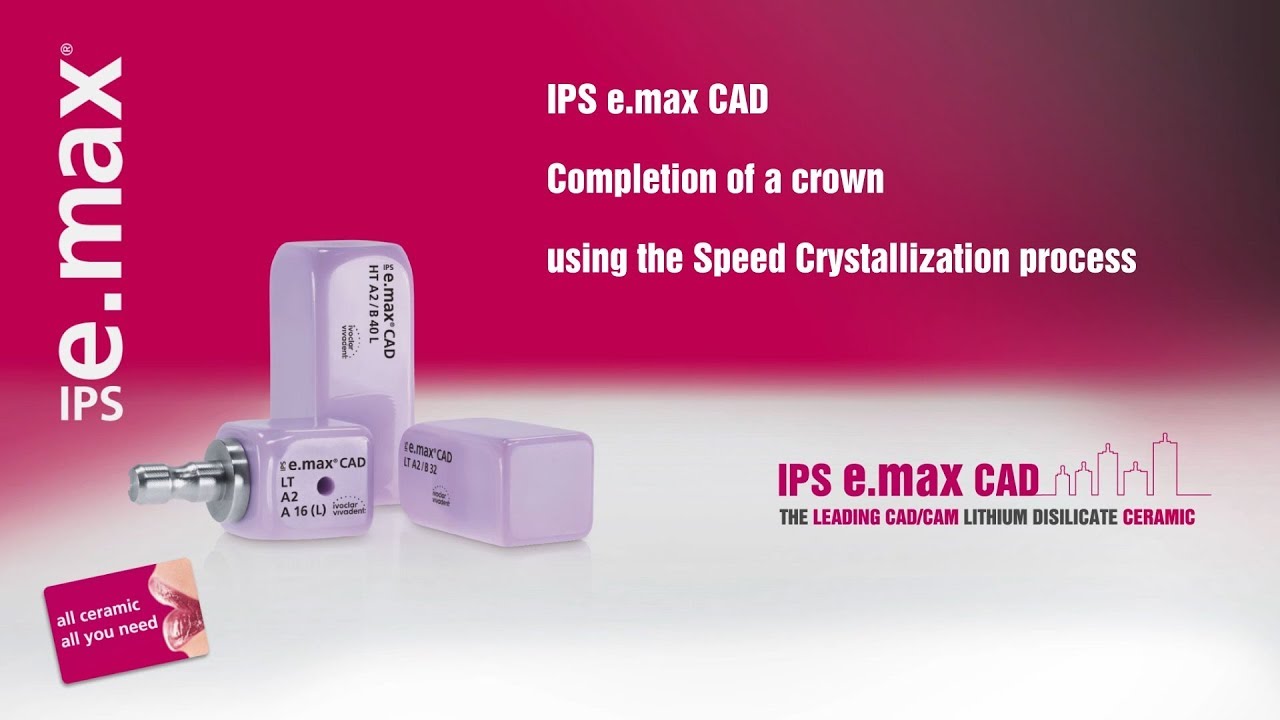 IPS e max CAD: Completion of a crown using the Speed Crystallization process