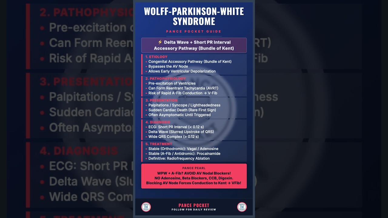 Wolff-Parkinson-White (WPW) Syndrome in 30 Seconds ⏱️ #PANCE #PAStudent #MedicalShorts