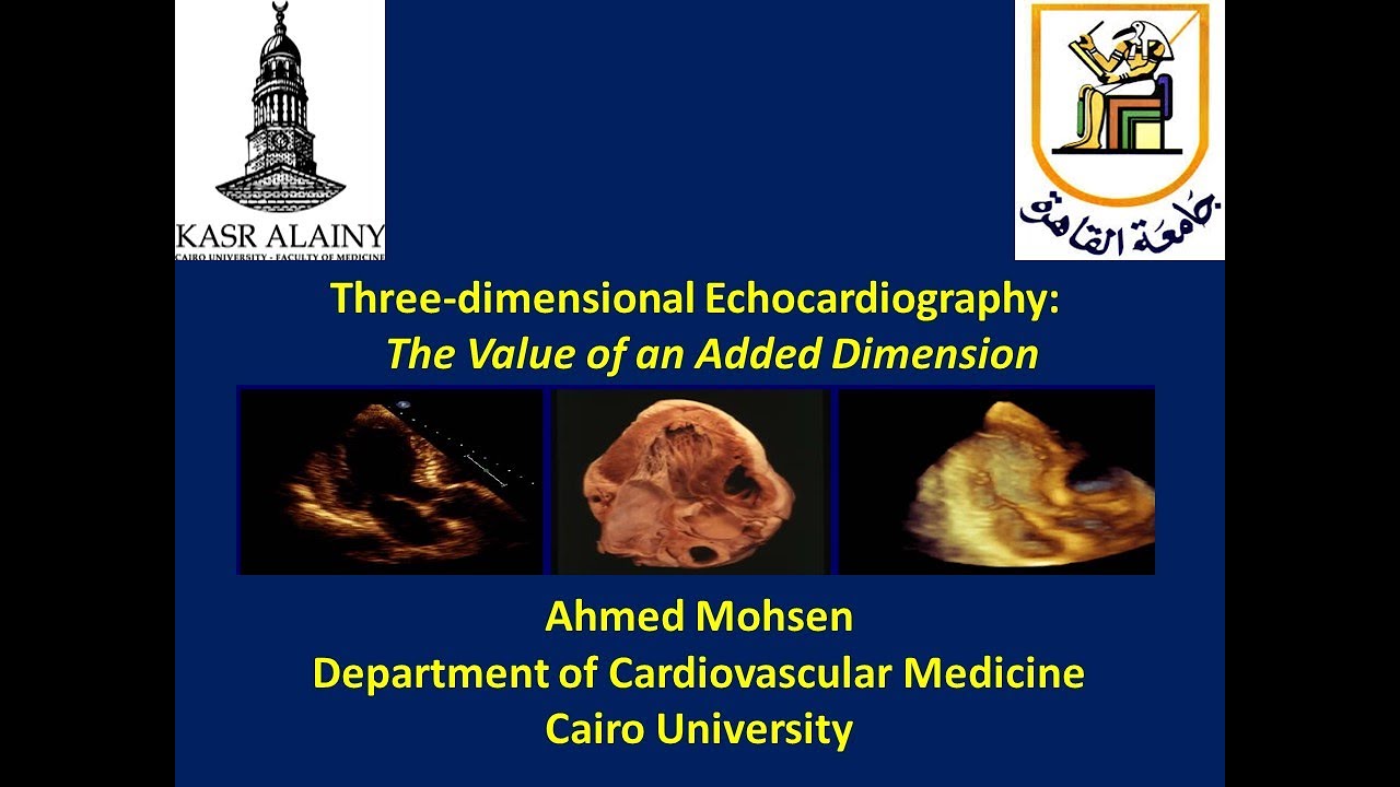 Basics and added value of 3D(three dimensional) Echocardiography