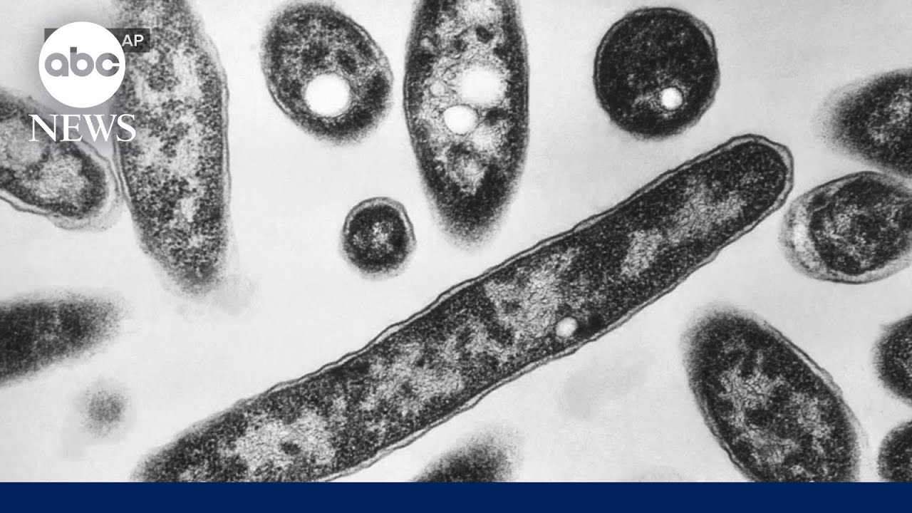 What to know about Legionnaires' disease