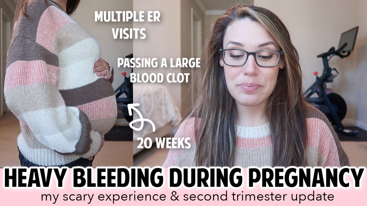 BLEEDING IN PREGNANCY - FIRST & SECOND TRIMESTER BLEEDING | SUBCHORIONIC HEMATOMA? PLACENTA PREVIA?