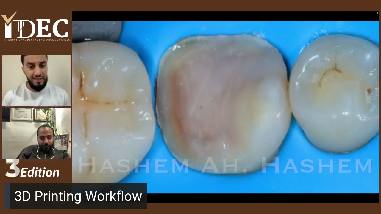 3D printing Workflow ||Dr.Hashem Ahmed