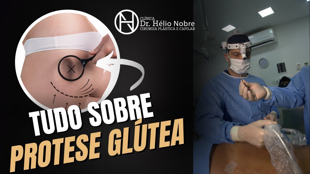 Tudo sobre Prótese Glútea | Dr. Hélio Nobre | Cirurgião Plástico