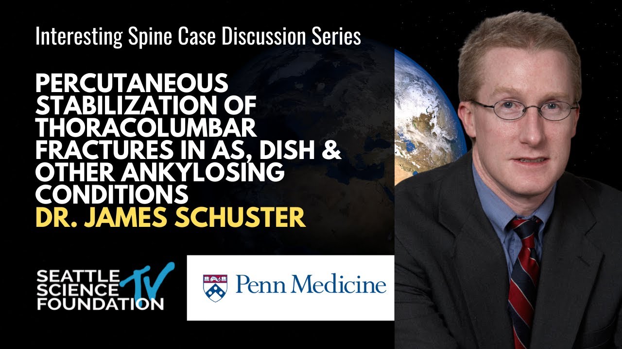 Percutaneous Stabilization of Thoracolumbar Fractures - James Schuster, M.D.
