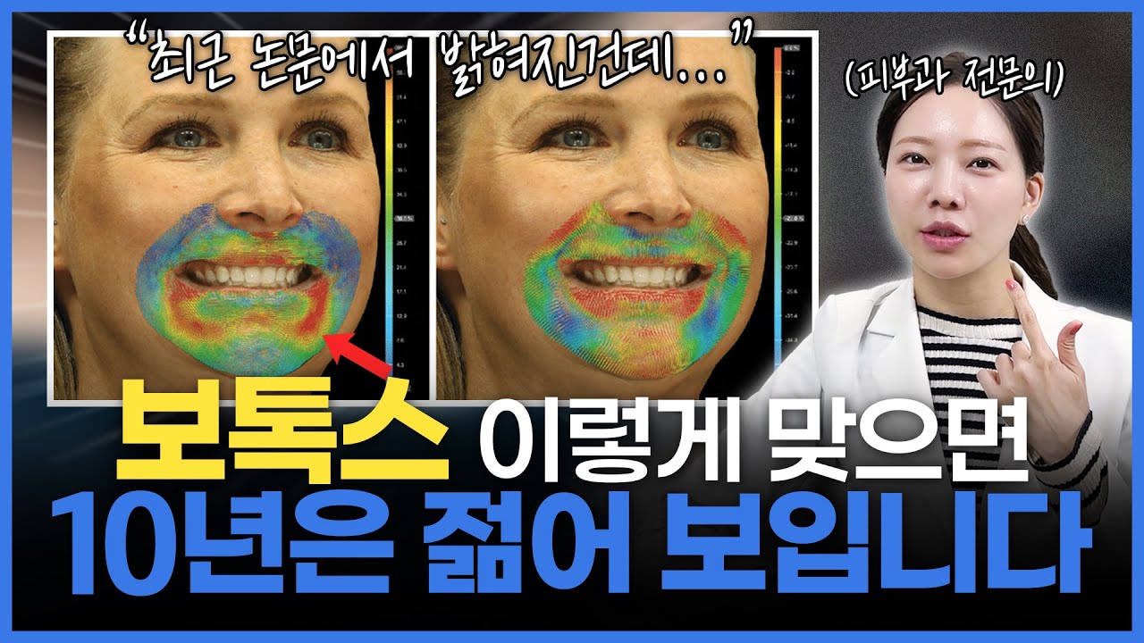 보톡스 효과 2배 높이는 방법 | 알려주기 아까운 피부과 의사의 보톡스 영업 비밀