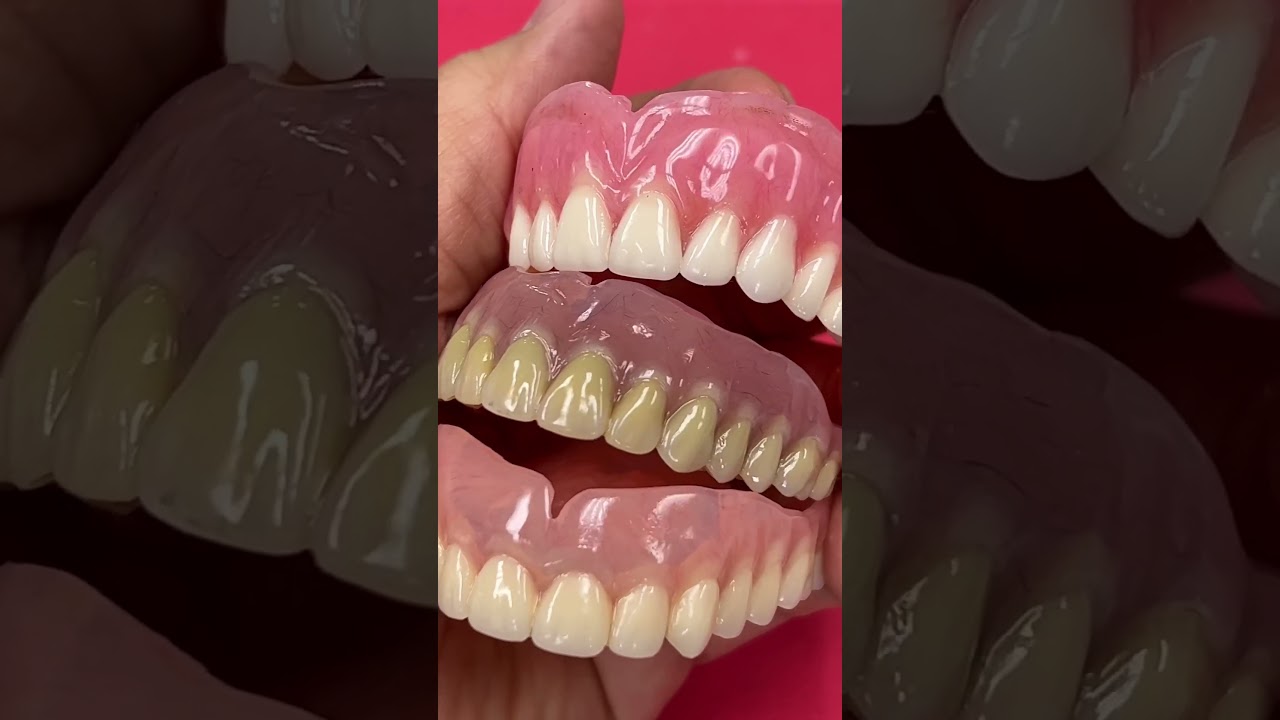 3 different denture characters!