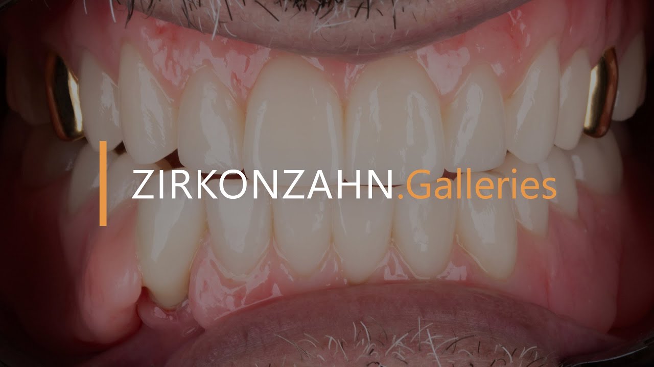Florence Totalprox® Denture System | Zirkonzahn.Galleries