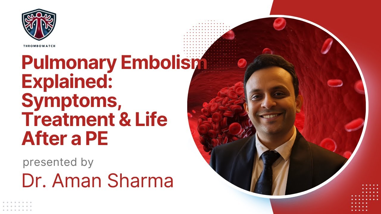 Pulmonary Embolism Explained  Symptoms, Treatment & Life After a PE | Dr  Aman Sharma