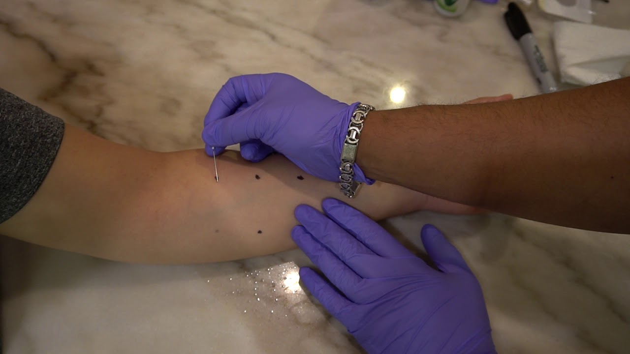 |ASMR| Medical testing ~ WEIRD Allergy Test By Dr Brian~