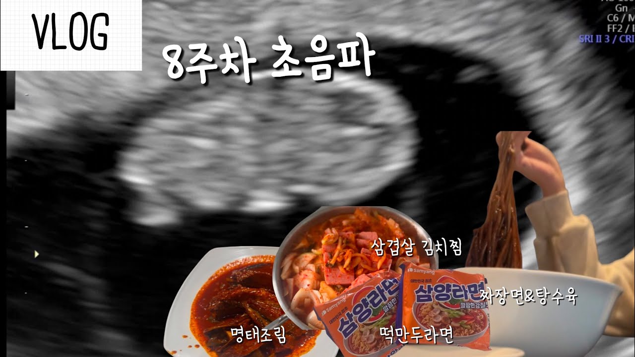 [VLOG] 임신 8주차 | 두근두근 초음파 | 조리원 예약 | 입덧인가 먹덧인가