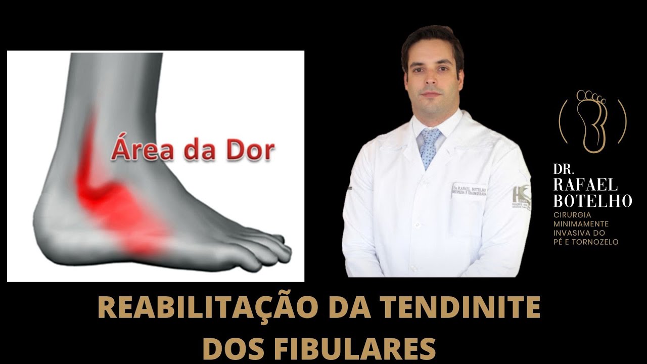 REABILITAÇÃO DA TENDINITE DOS FIBULARES