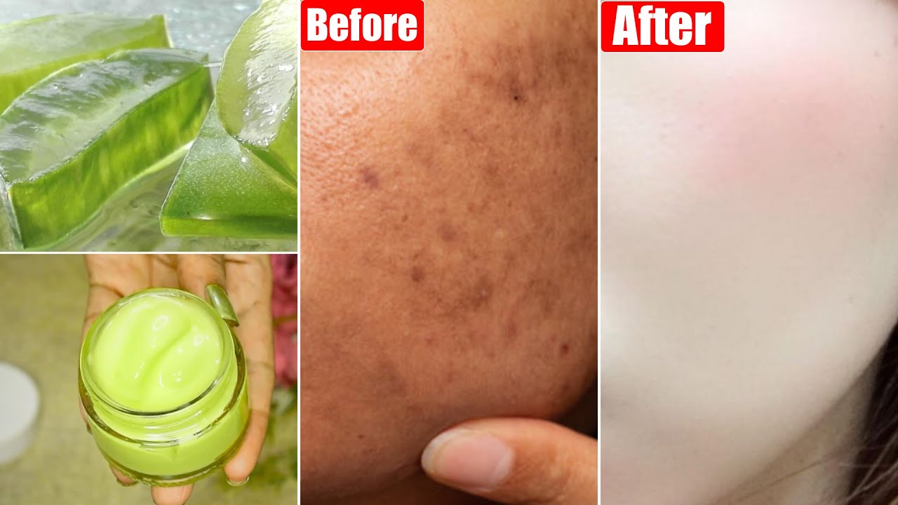New Aloevera Skin Whitening Face Cream-For Dull Dark Skin-Pigmentation & Dark Spots-Get Glowing Skin