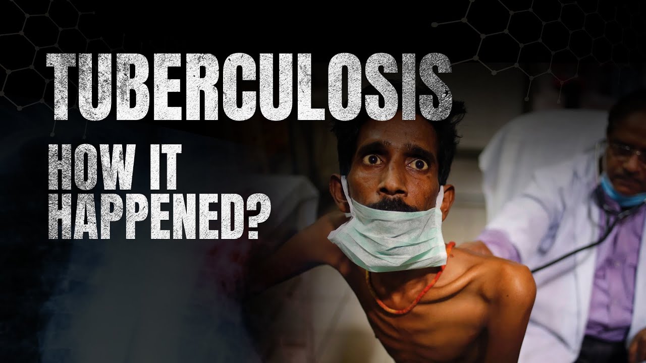 Tuberculosis: The Story & How it Happened | PrepLadder Neet PG
