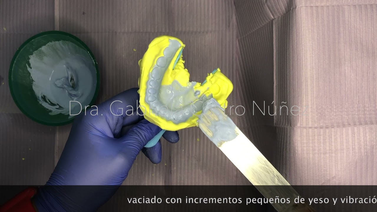 Impresión Odontológica con Alginato | Dra. Gabriela Castro Núñez