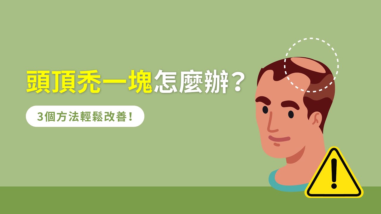 【完整版】頭頂禿一塊怎麼辦？3個方法輕鬆改善！｜植髮診所推薦【ihair風華御髮】