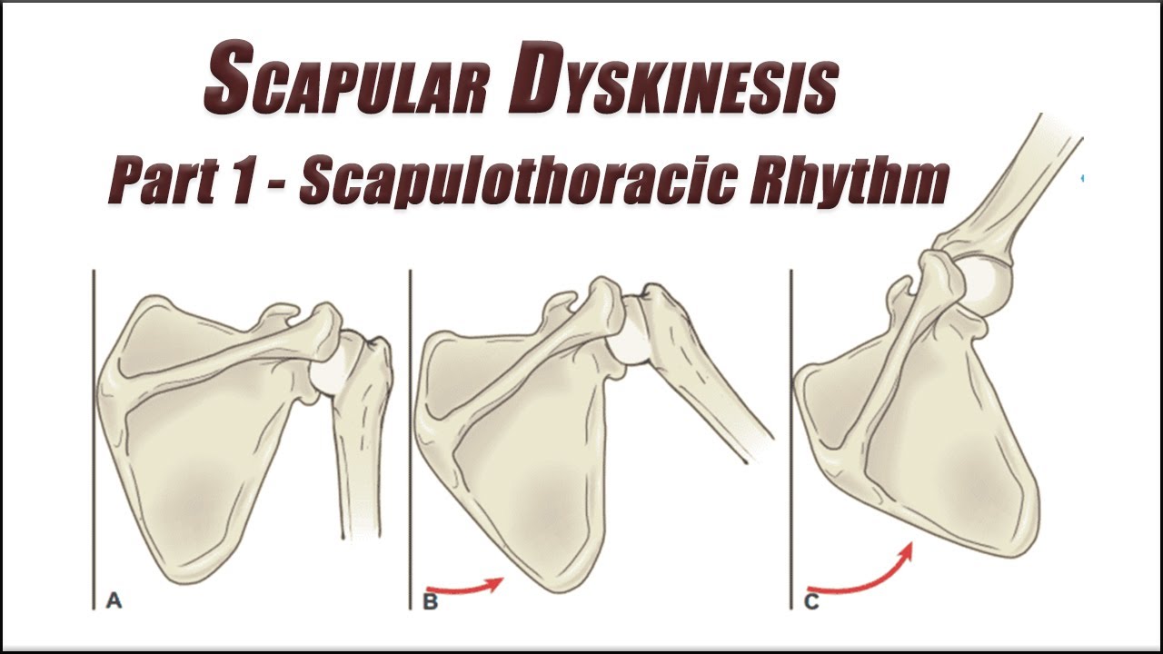 Fix Your Scapular Dyskinesis Part 1 | Scapulothoracic Rhythm Exercises