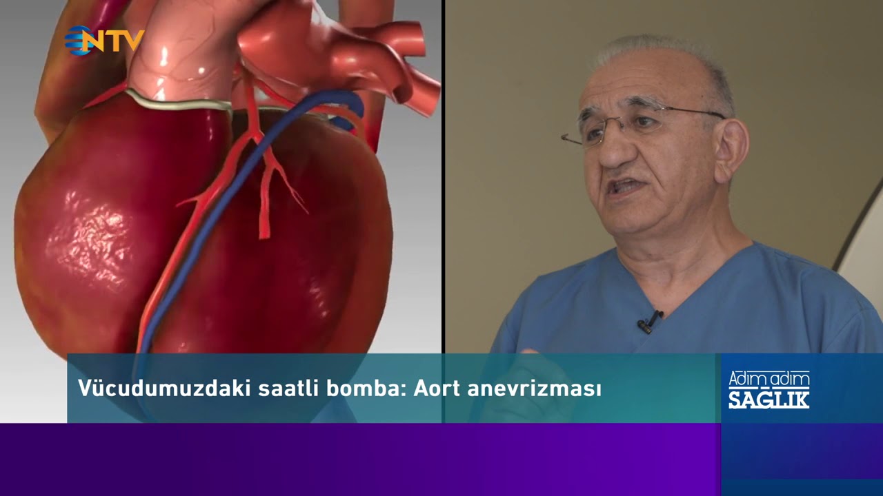 Vücudumuzdaki Saatli Bomba: Aort Anevrizması