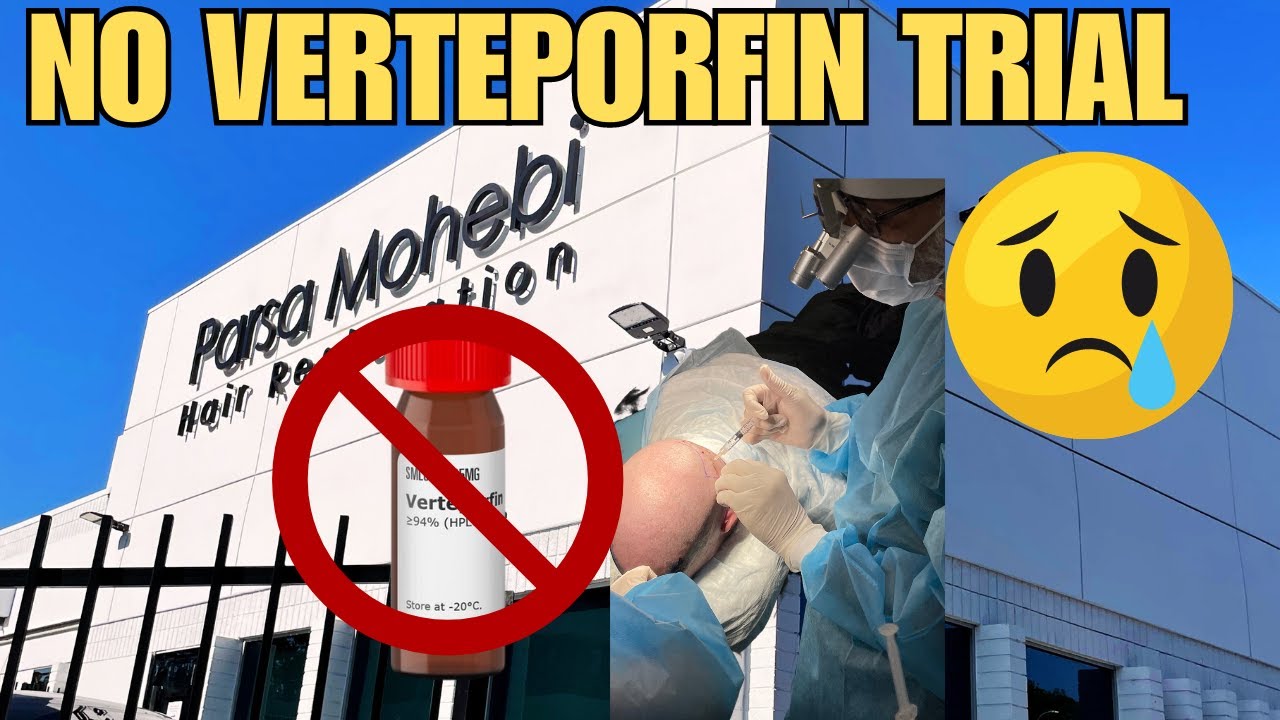 Dr. Parsa Mohebi- Verteporfin, Non-Shaven FUE, Juvenile Hairlines, Mohebi Life Natural DHT Blocker