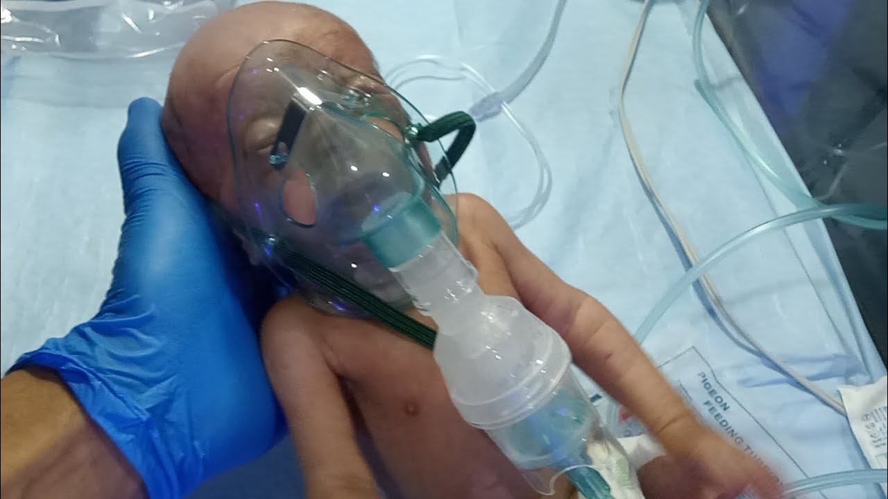Critical Condition Newborn Nebulizer Protocol |NICU Emergency Respiratory Care |Male Nurse Procedure