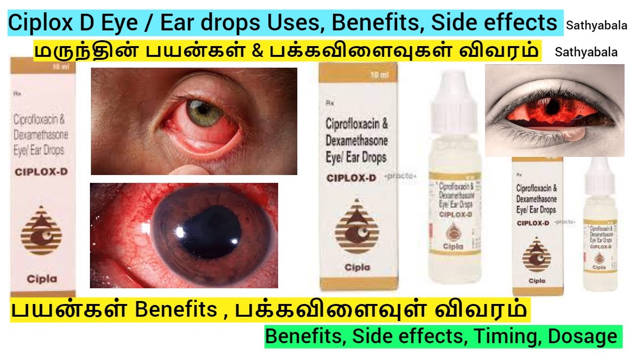 ciplox d eye ear drops, ciplox d eye ear drops uses in tamil, ciplox d eye  drops, ciplox drops