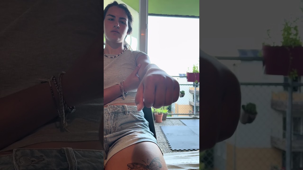 Cas clinique kiné 2 : bilan main/poignet J-12 post opé ostéosynthèse du radius ( fracture déplacée )