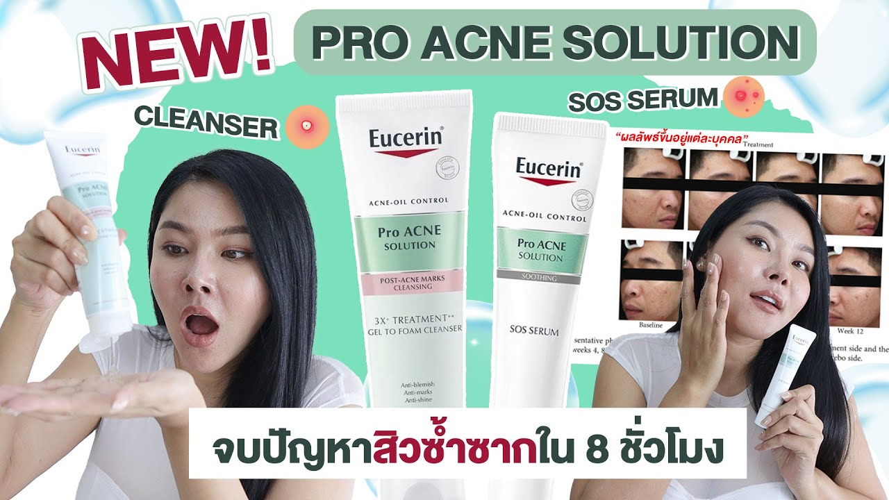 (กูรูเช็ค)  EUCERIN SOS SERUM และ 3X Treatment Gel to Foam Cleanser จบทุกสิวซ้ำซาก ใน 8 ชม.