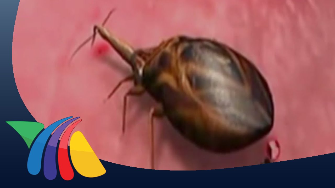 ¿En qué consiste la enfermedad de chagas? | Noticias de Salud