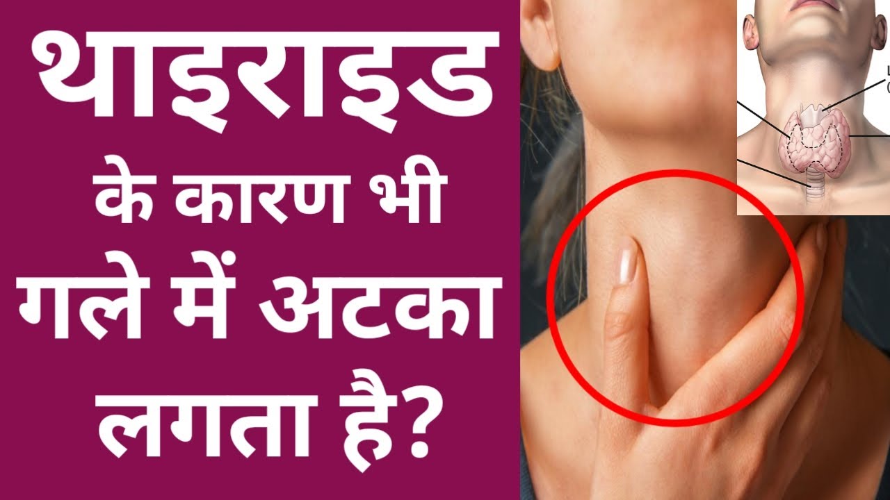 Something in my throat due to thyroid,क्या थाइराइड के कारण भी गले में कुछ अटका हुआ महसूस हो सकता है?