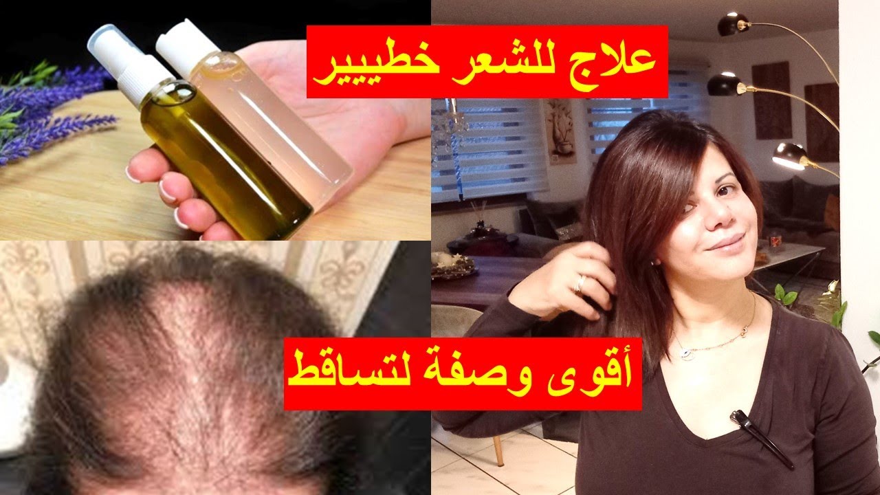 عمرني شفت شي دوا 🔊بحالو كيعالج #وكيطول  الشعر #بشكل خطيير💯