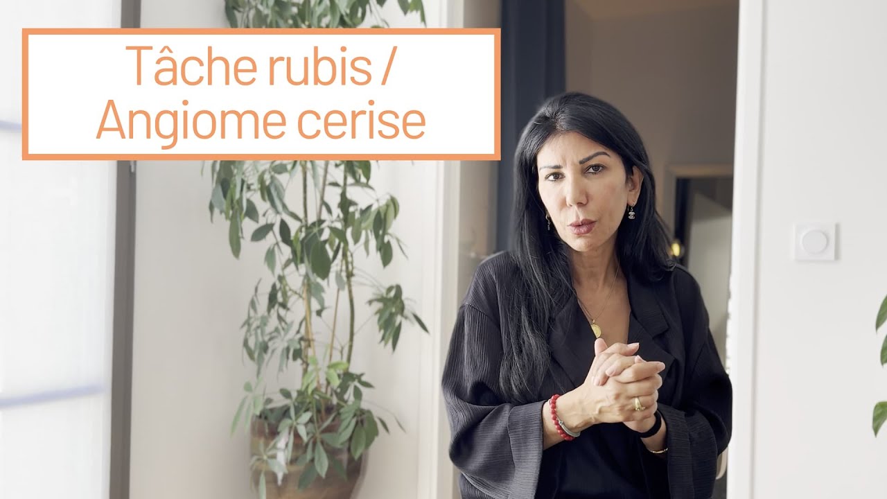 T&acirc;che rubis / Angiome cerise
