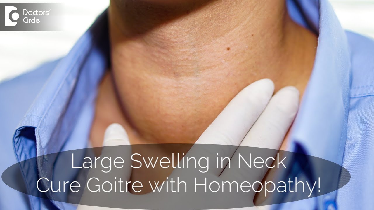What Is Goitre? How Is It Treated With Homeopathy? - Dr. V. Bhagyalakshmi | Doctors' Circle