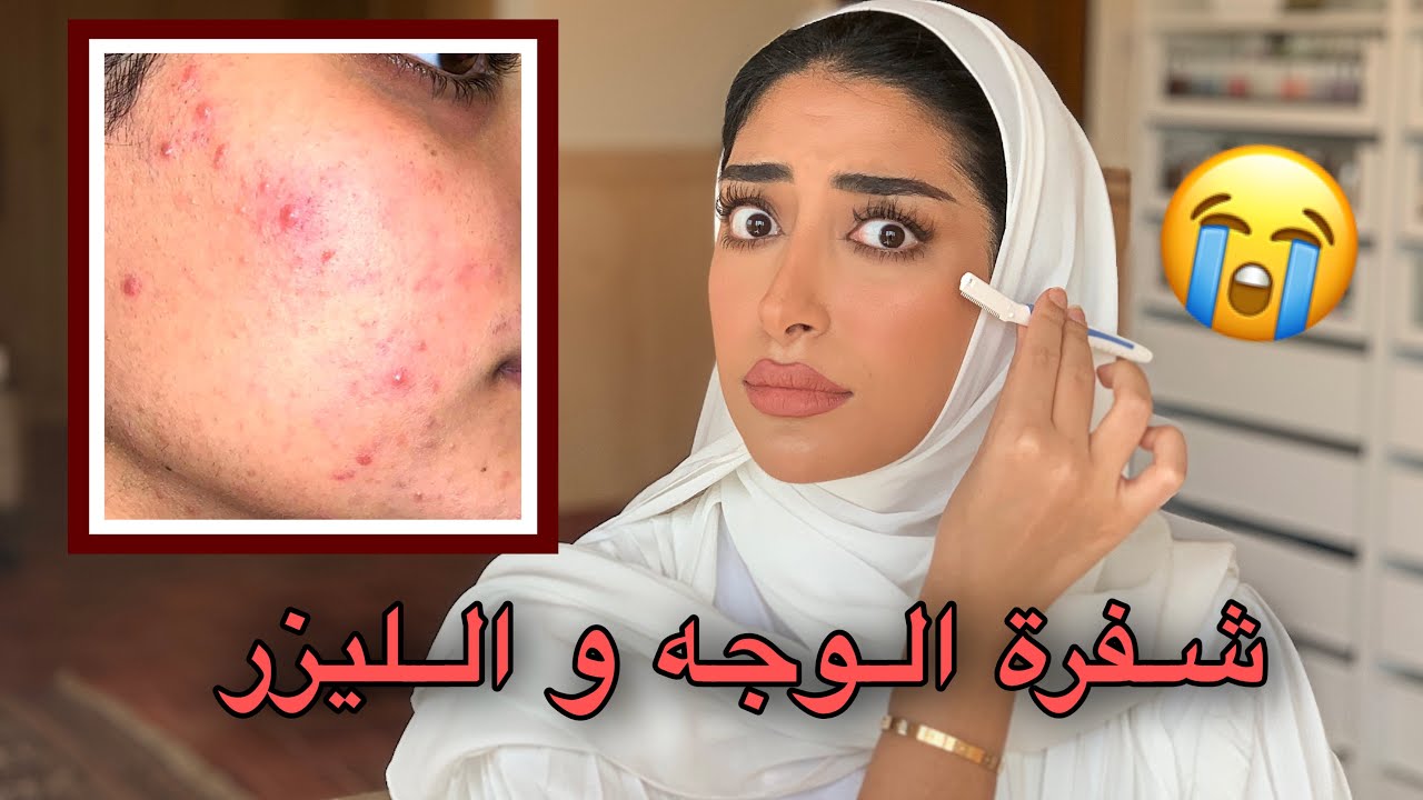 تجربتي مع ازالة شعر الوجه بالشفره و الليزر😭💔 انصدمت !! || فاطمة المهنا ✨